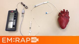 Placing a Transvenous Pacemaker [upl. by Estey380]