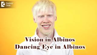 Vision problems in Albinos  Dancing Eyes in Albinos  Dr Sunita Rana Agarwal  Doctors Circle [upl. by Olivann]