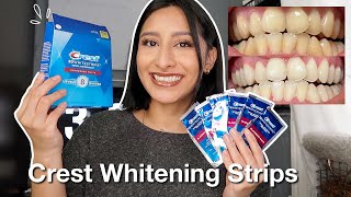 I TRIED THE CREST 3D WHITESTRIPS FOR 14 DAYS Effective  Before amp After pictures [upl. by Eelirol]