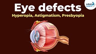 Eye defects  Hyperopia Astigmatism Presbyopia  Dont Memorise [upl. by Avelin84]