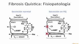 Fibrosis quisticamp4 [upl. by Rosemare]