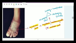 Subcutaneous Deep Mycoses  Microbiology  Image based discussion [upl. by Sjoberg]