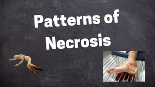 Morphology of Necrosis [upl. by Hurlbut726]