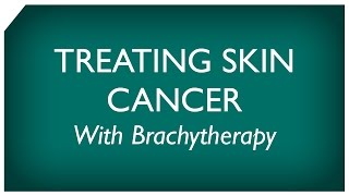 Brachytherapy for Skin Cancer [upl. by Stanwood]