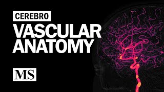 Cerebral Venous Sinus Thrombosis CVST Animation [upl. by Macnair]