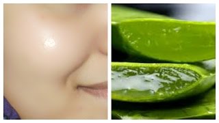 How to get clear glowing spotless skin by using aloe Vera gel [upl. by Noerb]