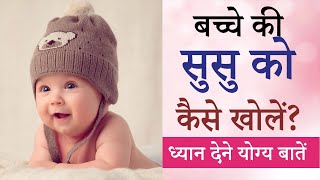 Baby Boy ka susu kaise khole  Kaise Open Kare  How to open private part of Baby Boy [upl. by Alston]