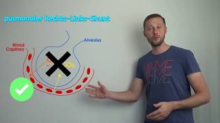 Arteriovenous Shunts  Cardiovascular system  Step 1 Simplified [upl. by Avivah]