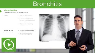 Pneumonia Introduction amp Types – Respiratory Medicine  Lecturio [upl. by Dix471]