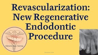 Abdominal Vasculature  Dissection Supplement [upl. by Sisile684]