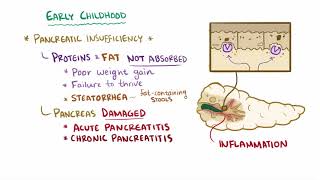 Cystic fibrosis causes symptoms diagnosis treatment amp pathology [upl. by Anirol34]