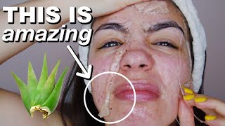 I Used ALOE VERA On My Skin For 5 Days amp This Is What Happened [upl. by Nuavahs]