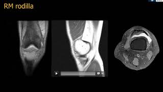 Anatomía RM Rodilla [upl. by Nrehtak]