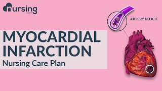 How to care for Myocardial Infarction as a nurse Nursing Care Plan [upl. by Norbie]