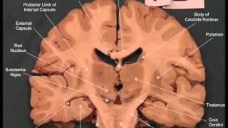 Neuroanatomy  Coronal Brain Slices [upl. by Ancelin]