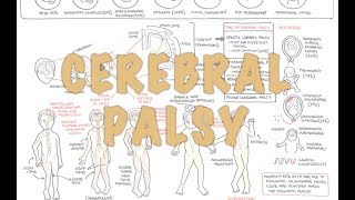 Cerebral Palsy  DETAILED Overview [upl. by Yditsahc]