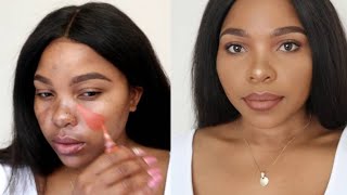 HOW TO COVER HYPERPIGMENTATION AND DARK SPOTS ON BROWN SKIN [upl. by Jolda]