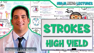 Ischemic and Hemorrhagic Strokes  High Yield [upl. by Aitekram499]