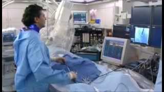 postablation procedure [upl. by Ydnerb]