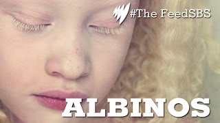 Albinos In Brazil [upl. by Vareck]