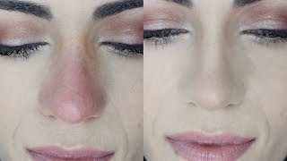 How To Cover Nose REDNESS And MAKE IT LAST  MakeupAndArtfreak [upl. by Lamek513]