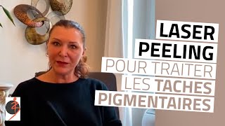 Traitement des taches pigmentaires avec laser ou peeling chez le Dr Navarro à AixenProvence [upl. by Katti834]