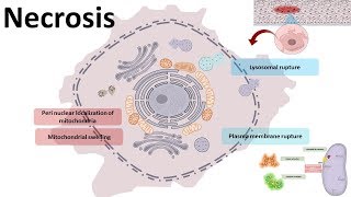 Necrosis  cellular mechanism and types [upl. by Adnoek]