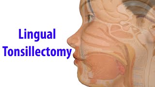 The Tonsils Anatomy and Physiology [upl. by Albert858]