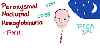 Paroxysmal Nocturnal Hemoglobinuria PNH  Hemolytic Anemia  Complement Alternative Pathway [upl. by Nolie65]