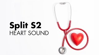 Fixed Split S2  Heart Sounds  MEDZCOOL [upl. by Idyak]