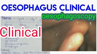 OESOPHAGUS clinical anatomy and vascular supply [upl. by Sandra]