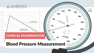 Invasive Arterial Blood Pressure Measurement [upl. by Hermy]