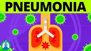 Pneumonia Overview  Causes Symptoms Diagnosis and Treatment [upl. by Ailey224]