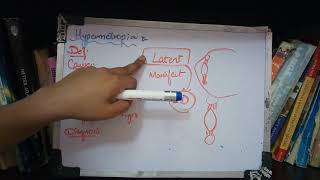 HYPERMETROPIA important topic full explanation part 1 [upl. by Prue452]