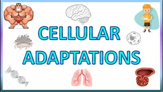 Hyperplasia amp Atrophy  Cell Adaptations 23  General Pathology  EOMS [upl. by Antonin]