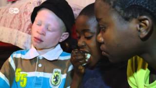 Kenya  Albinos Face Deadly Superstition  Global 3000 [upl. by Annagroeg]