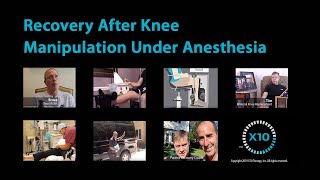 Recovery After Knee Manipulation Under Anesthesia [upl. by Utham]