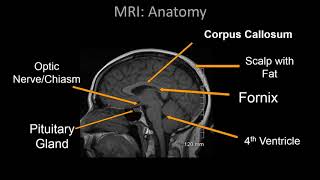 Limbic Neuroanatomy Video Lab  Brain Dissections [upl. by Champagne761]