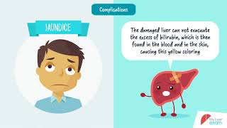 What is liver cirrhosis [upl. by Yttam]