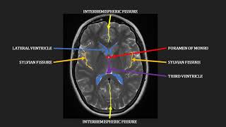 Embryology of the CNS Easy to Understand [upl. by Aisauqal]