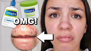 I Used Cetaphil Skincare For One Week [upl. by Luane]