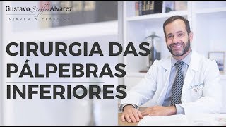 Cirurgia das pálpebras inferiores [upl. by Airbmat251]