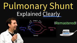 Understanding Shunt Fraction QpQs [upl. by Teodor610]