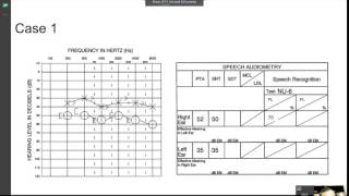 speech audiometry practice [upl. by Eikcuhc]