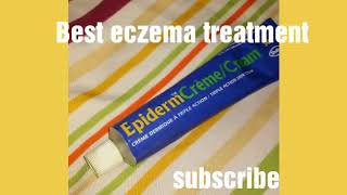 Epiderm cream  How to use Epiderm Cream  uses of Epiderm cream [upl. by Ambrosius]