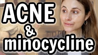 Minocycline versus doxycycline for acne Dr Dray [upl. by Eugenius52]