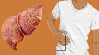 Liver Explained Clearly  Pathophysiology LFTs Hepatic Diseases [upl. by Atekan319]