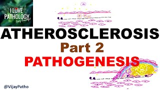 ATHEROSCLEROSIS  Part 2 Pathogenesis [upl. by Sherwin284]