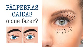 PaÌlpebras caiÌdas o que fazer [upl. by Noved]