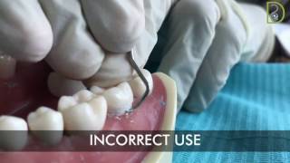 Dentiscope  How to use supragingival scalers [upl. by Adialeda]